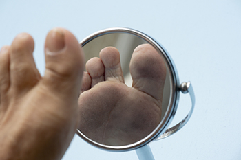 Diabetics foot patient looking at foot in mirror