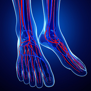 Poor Circulation infographic of patients blood vessels in the feet